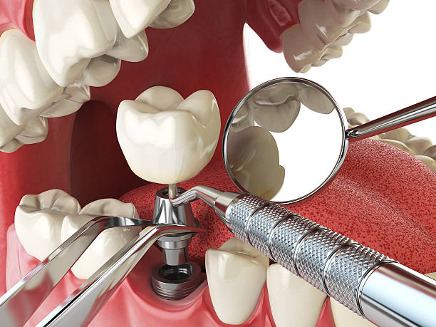 Best Emergency Treatment for Toothache in Elk City, OK